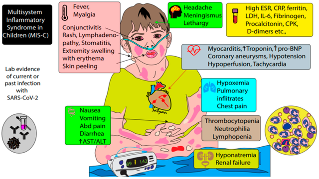 Paediatric Inflammatory Multisystem Syndrome - ScoreBetter